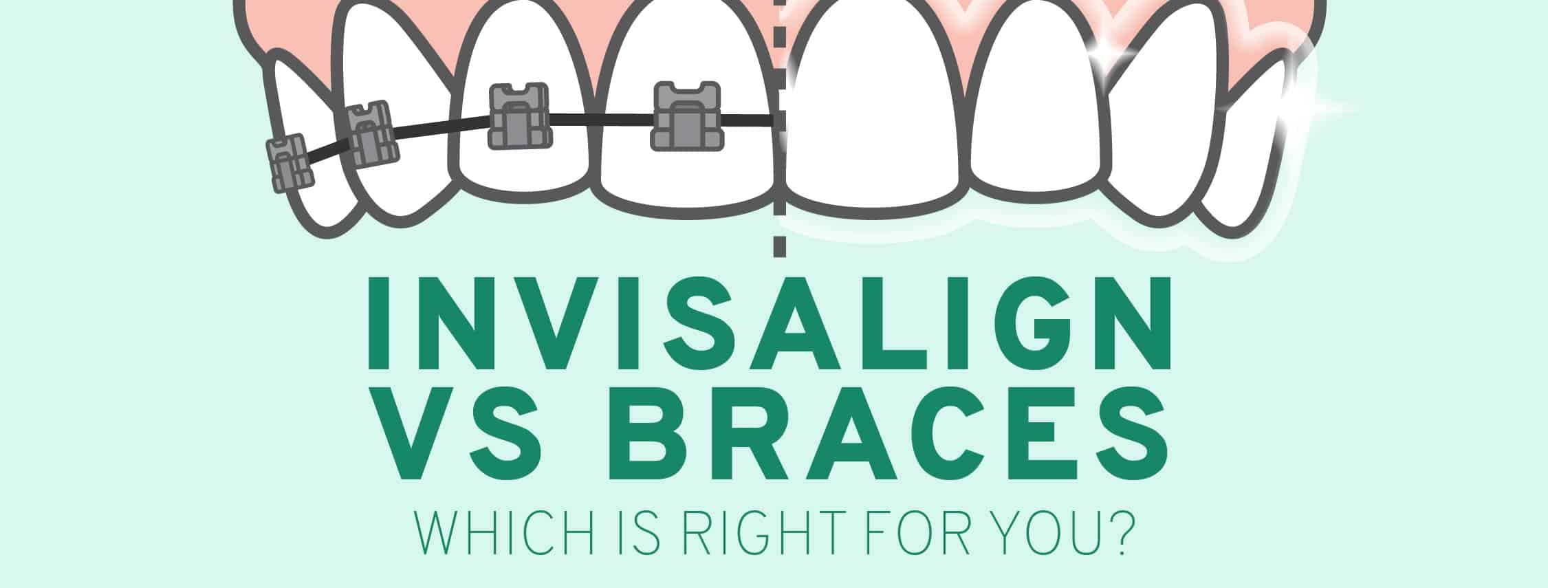 Traditional Metal Braces vs. Invisalign®