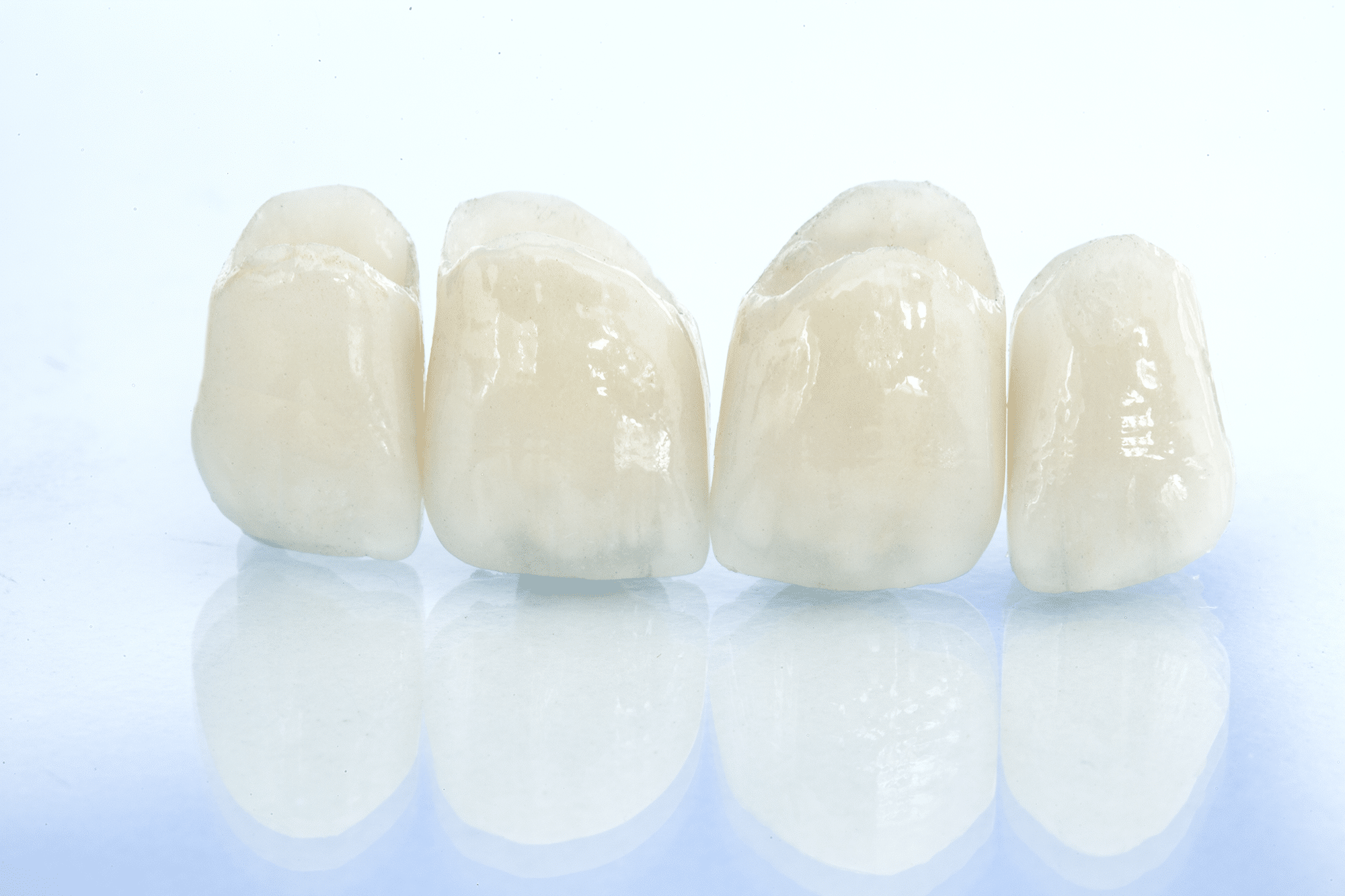 what are the different types of dental crowns Genesis Dental and Orthodontics bright smiles dental, dentist near me, children's dentistry, pediatric dentistry, family dentisry, general dentistry, cosmetic dentistry, braces, metal braces, traditional braces, invisalign, clearcorrect, clear aligners, damon brackets, emergency dental dentistry, dental implant, implants, crown, crowns, cerec, filling, fillings, sealant, sealants, bond, bonding, frenectomy, gum recontouring, root planing, dentures, partial denture, full dentures, implant retained denture, cracked tooth, loose teeth, discolored tooth porcelain fillings, tooth-colored amalgam fillings, dental exam, xray, cleaning, cleanings, teeth whitening, zoom whitening, dentist open on saturday, dentist open on sunday, emergency dentist serving utah and kansas, serving SALT LAKE CITY, UT,TAYLORSVILLE, UT, SOUTH JORDAN, UT, OREM, UT, MAGNA, UT, WEST VALLEY CITY, UT, DISTRICT ORTHODONTICS UT, BRIGHT SMILES DENTAL UT, THANKSGIVING POINT, CENTRAL AVE DENTAL KS, OVERLAND PARK, KS
